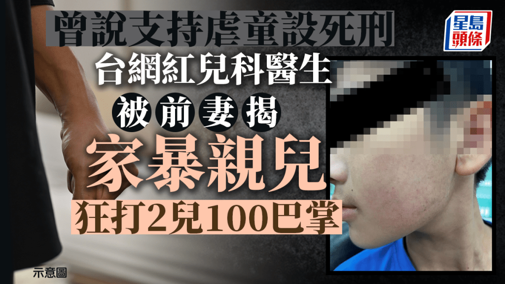 小孩的生母表示,照片為遭前夫家暴的兒子事發隔天在警局所拍攝,傷勢並不是輕微紅腫,是整片瘀青。「嘎老師Miss Ga」FB