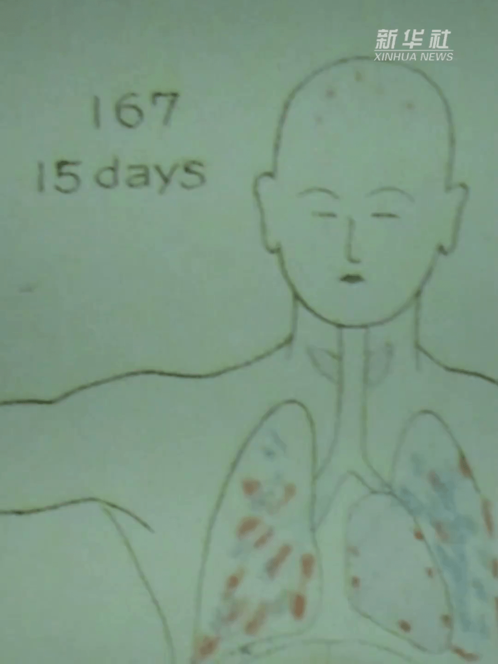 前七三一部隊成員親述細菌戰罪行。 前七三一部隊成員親述細菌戰罪行。