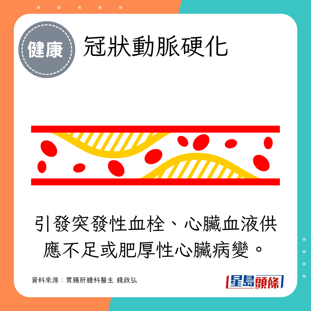 冠状动脉硬化引发突发性血栓、心脏血液供应不足或肥厚性心脏病变。