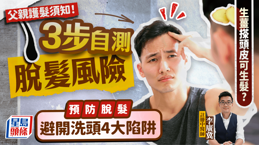 父親節護髮|防脫髮避開洗頭4大陷阱 中醫教3步自測脫髮風險 生薑搽頭皮可生髮?