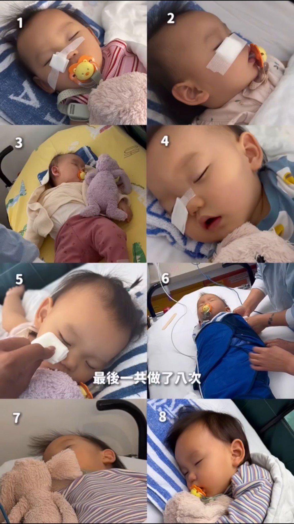 梁諾妍細女完成8次激光治療(圖片來源:IG@inez_leong) 梁諾妍細女完成8次激光治療(圖片來源:IG@inez_leong)