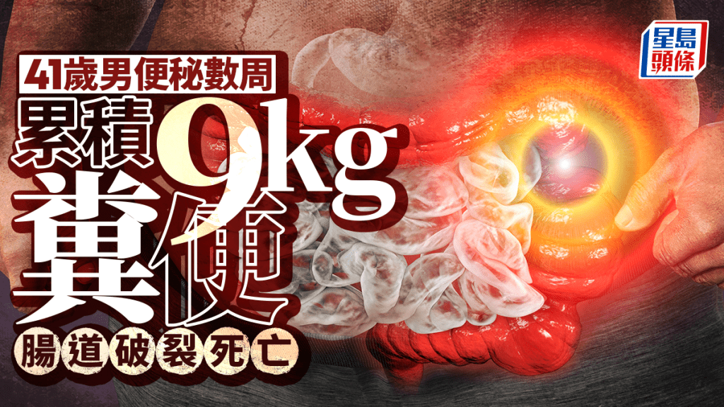 便秘慘劇｜身障男子痛苦1個月無人幫 9公斤大便塞爆腸亡