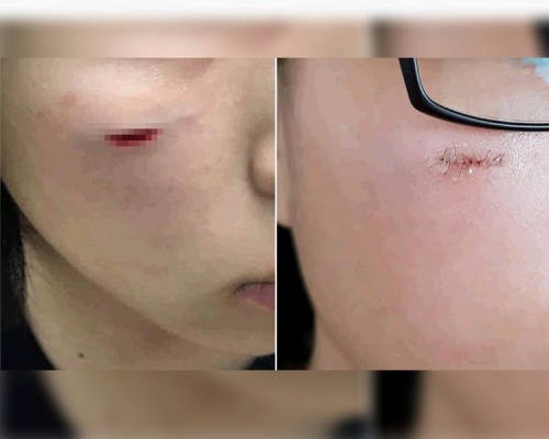 少女臉部被割傷留下頗深的傷口。fb