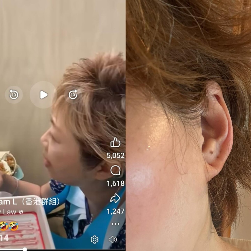 女子指自己左耳係癦，以及有3個耳洞。