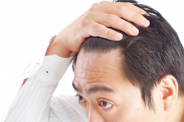 頭髮與血氣的關係密切，故脫髮患者特別要注重養血補腎。