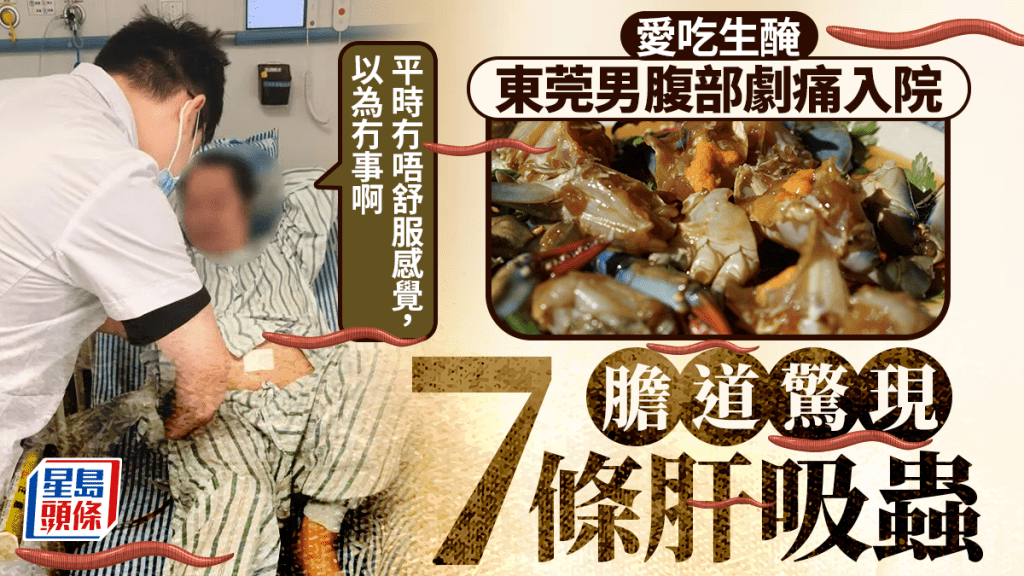 東莞男愛吃生腌海鮮，膽道內驚現7條肝吸蟲且大量蟲卵。