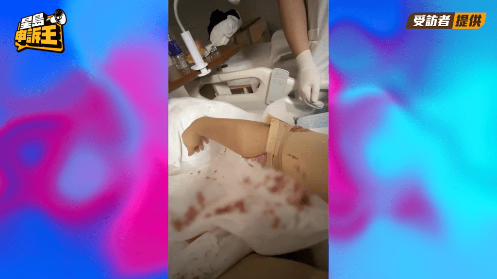 陳小姐在抽脂手術後多次出血，形容當時很害怕會死在那裹。(來源：被訪者提供)