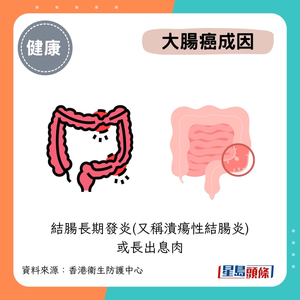 结肠长期发炎(又称溃疡性结肠炎)或长出息肉 结肠长期发炎(又称溃疡性结肠炎)或长出息肉
