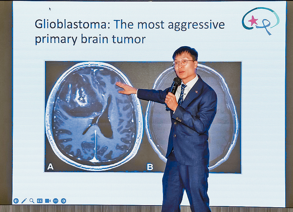 張嘉文醫生指，膠質母細胞瘤是很難醫治的原發性腦瘤，患者即使開刀也難完全清除。