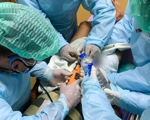 泰男自鎖下體卻丟失鑰匙,下體被卡2周險壞死。網圖