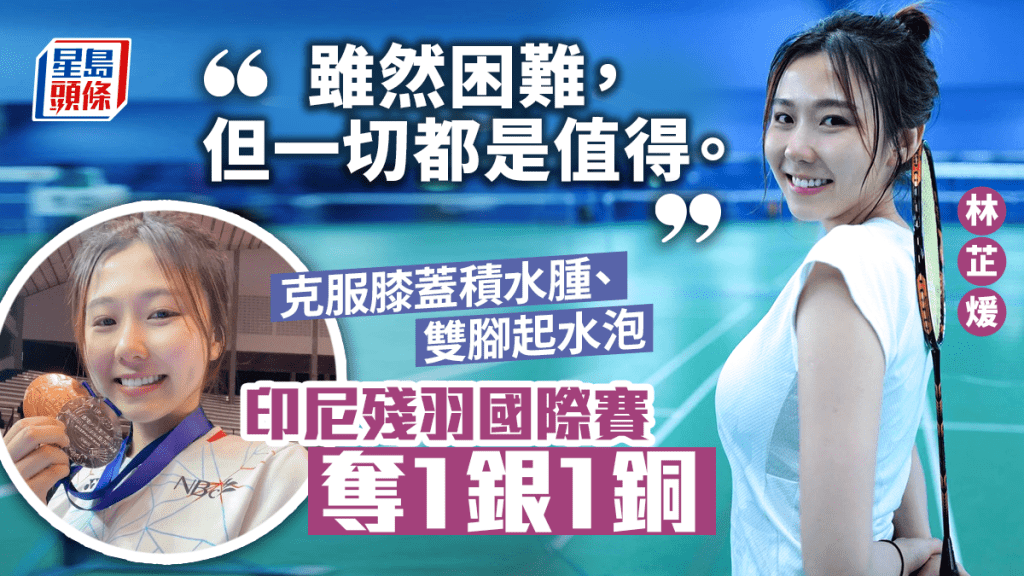 羽毛球|殘羽國際賽負傷攞牌 林芷煖萬人畀like
