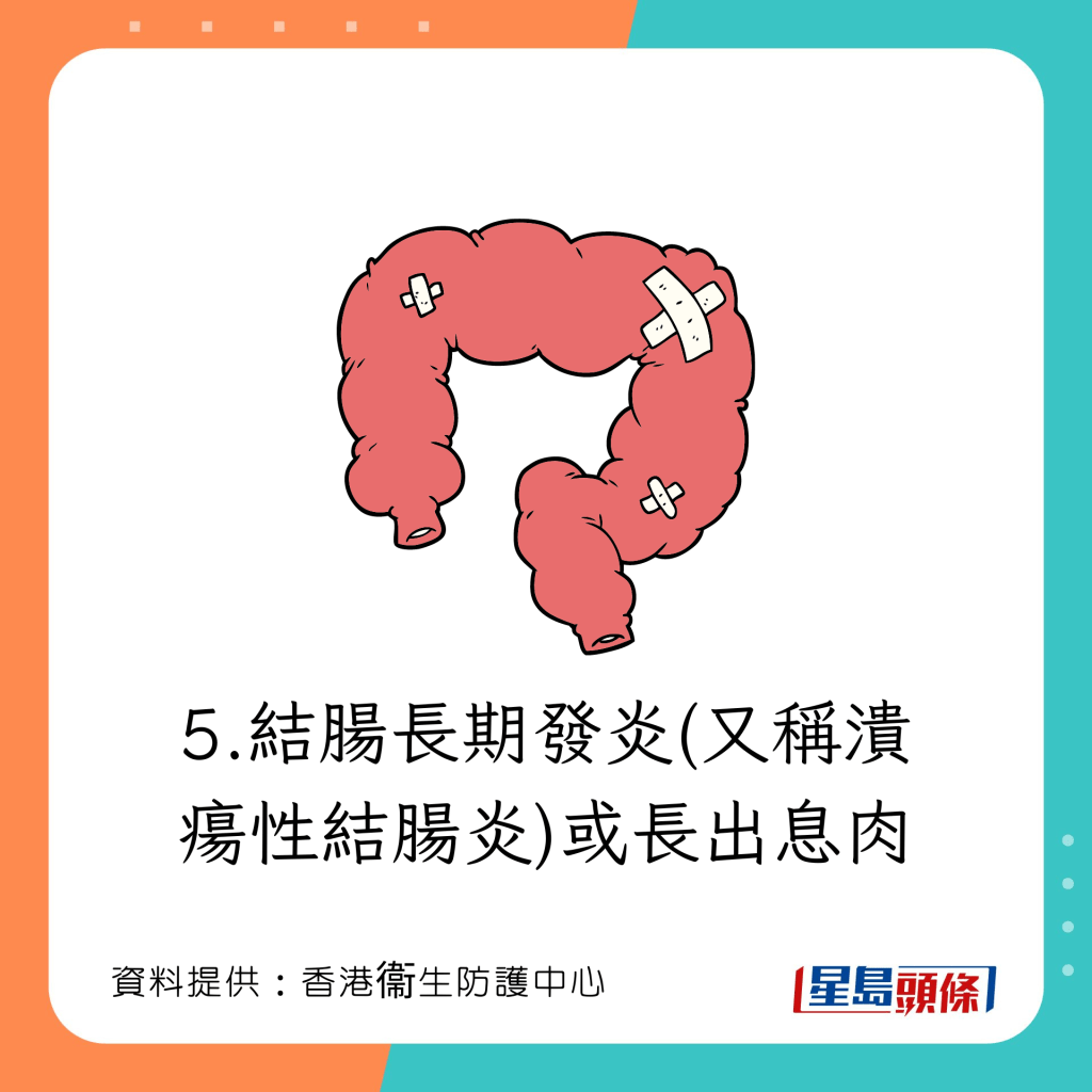 結腸長期發炎(又稱潰瘍性結腸炎)或長出息肉