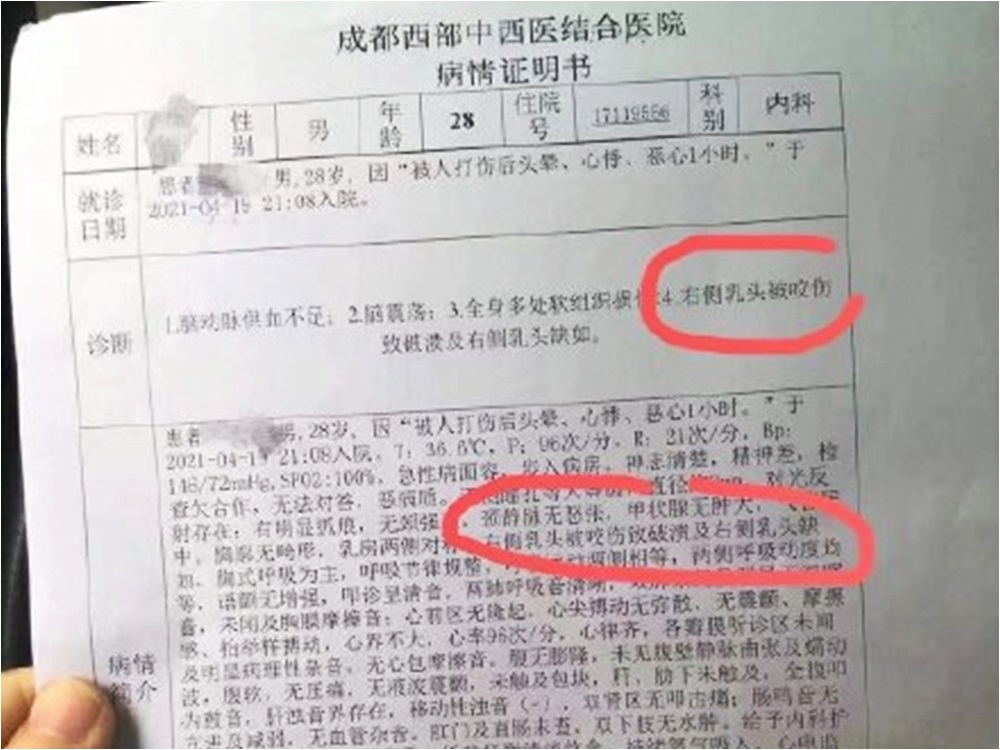 知情人士透露魏雷打不過人後便咬傷對手的乳頭。網圖