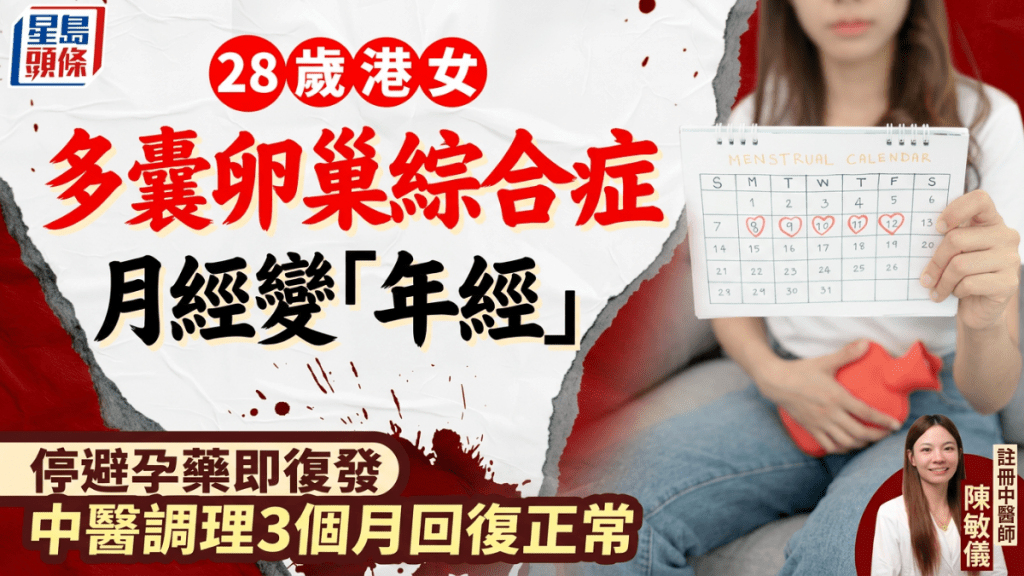 28岁港女多囊卵巢综合症 月经变「年经」停避孕药即复发 中医调理3个月回复正常