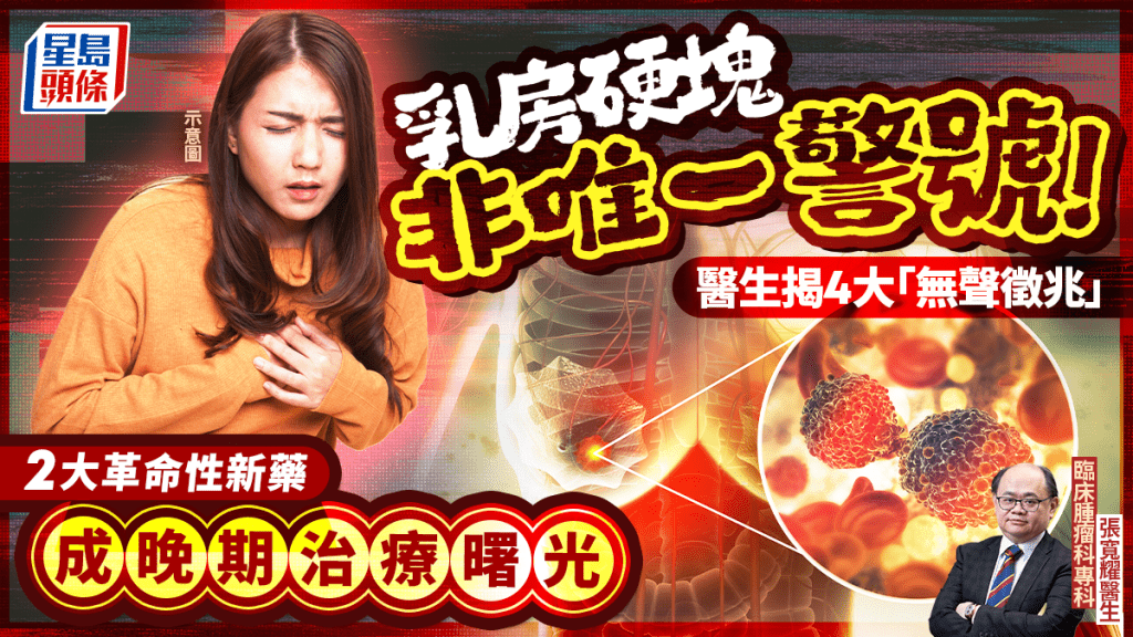 乳房硬塊非唯一警號！醫生揭4大「無聲徵兆」 2大革命性新藥 成晚期治療曙光