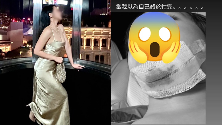 35歲前TVB女藝人陳渃晴回巢探朋友後出事 下巴爆缸成臉血傷勢曝光
