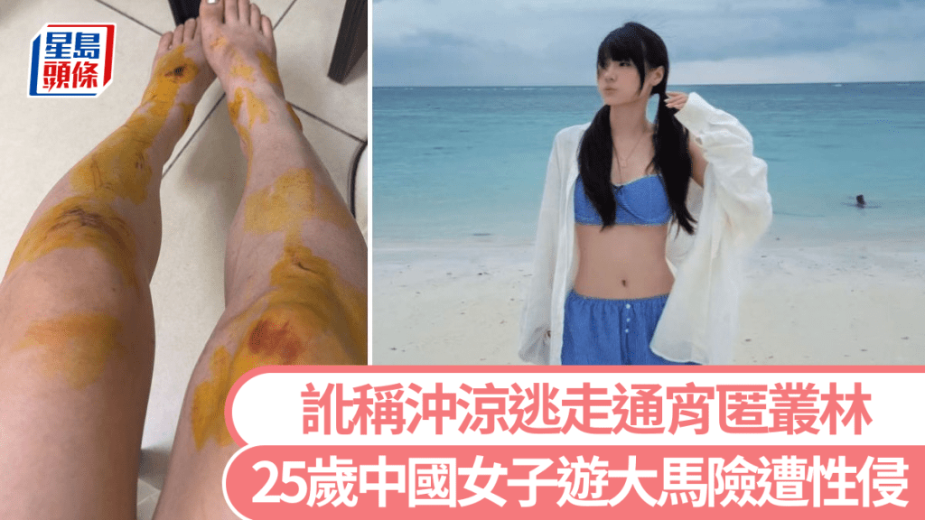 「土包子（在韓版）」在社交平台上載自己受傷的情況。抖音