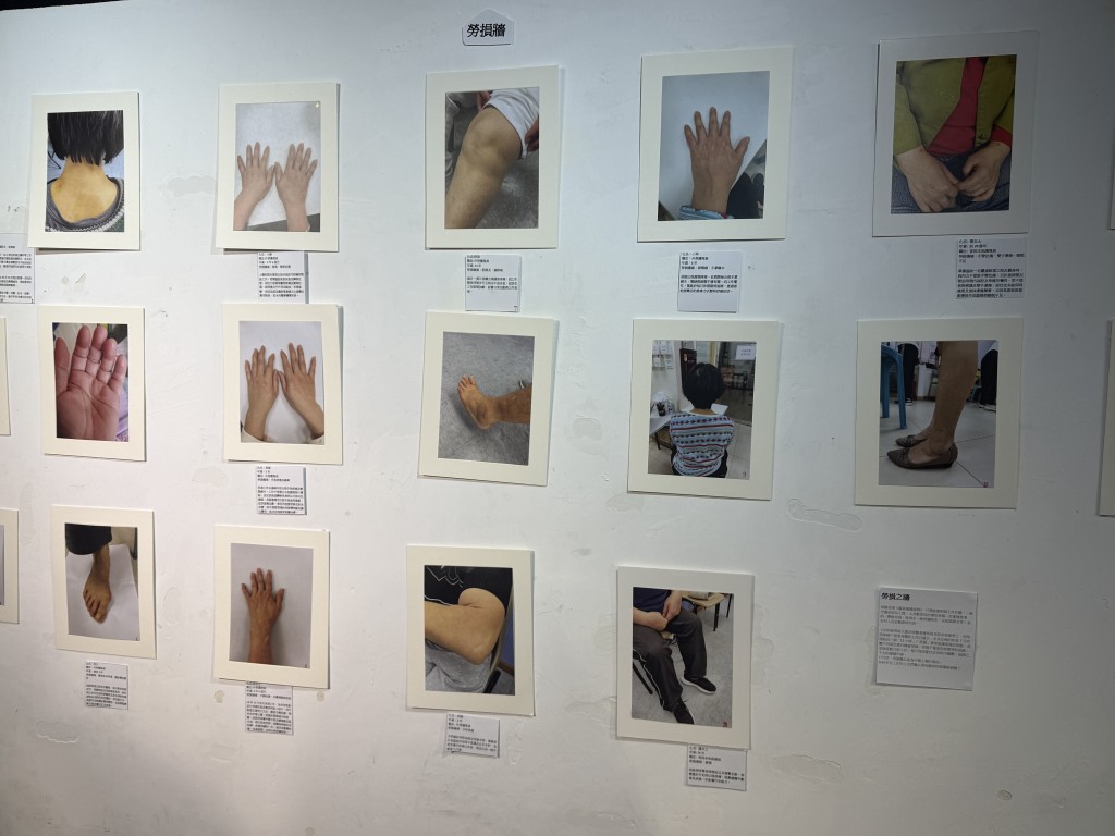 數據證實，年資越長勞損越嚴重，反映工作對身體造成累積性的損害。