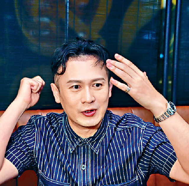 ■被脫髮問題困擾多年的Aaron,現在提起仍相當肉緊。 ■被脫髮問題困擾多年的Aaron,現在提起仍相當肉緊。