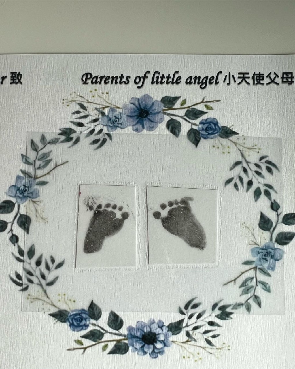莊韻澄胎兒患上罕有的巴陶氏症。