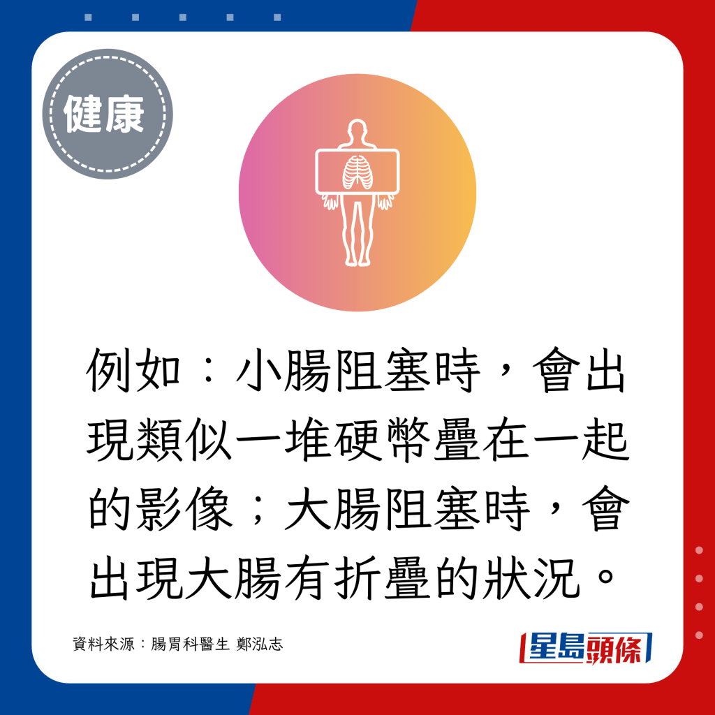 例如：小腸阻塞時，會出現類似一堆硬幣疊在一起的影像；大腸阻塞時，會出現大腸有折疊的狀況。