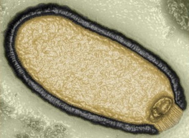 2014年从具有30000年历史永冻土样本中分离出来的阔口罐病毒（Pithovirus sibericum）显微镜放大图。 网上图片