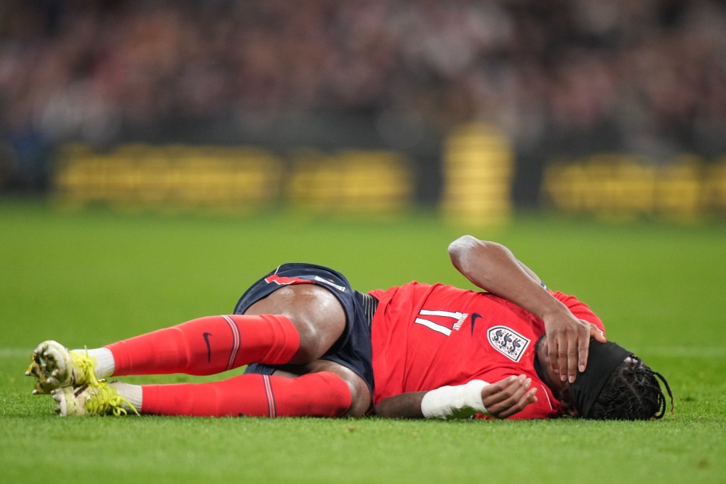 馬杜基在英格蘭賽和烏拉圭的賽事中受傷。美聯社