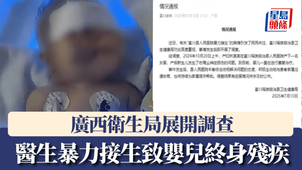 廣西醫生暴力接生致嬰兒終身殘疾，衛生局展開調查。