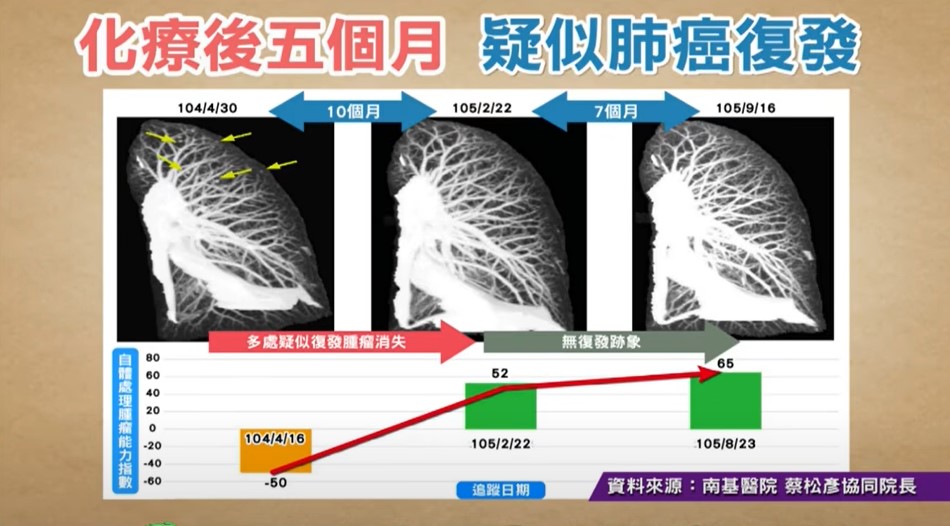 蔡松彥進行全素飲食後，癌症在化療段5個月有復發跡象。（《健康2.0》影片截圖）