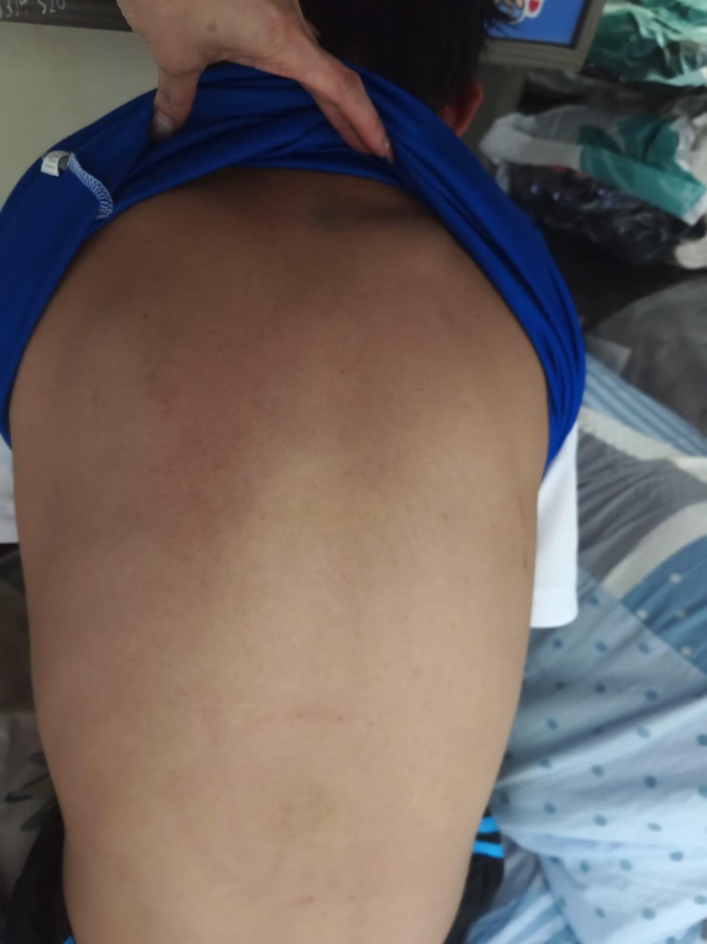 男童的脚、颈及背均有受伤。Threads@dvpp_1998图片