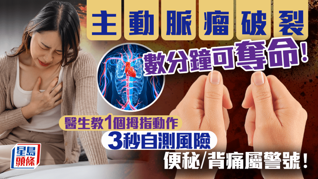 主動脈瘤破裂數分鐘可奪命!醫生教1個拇指動作自測風險 便秘/背痛屬警號!