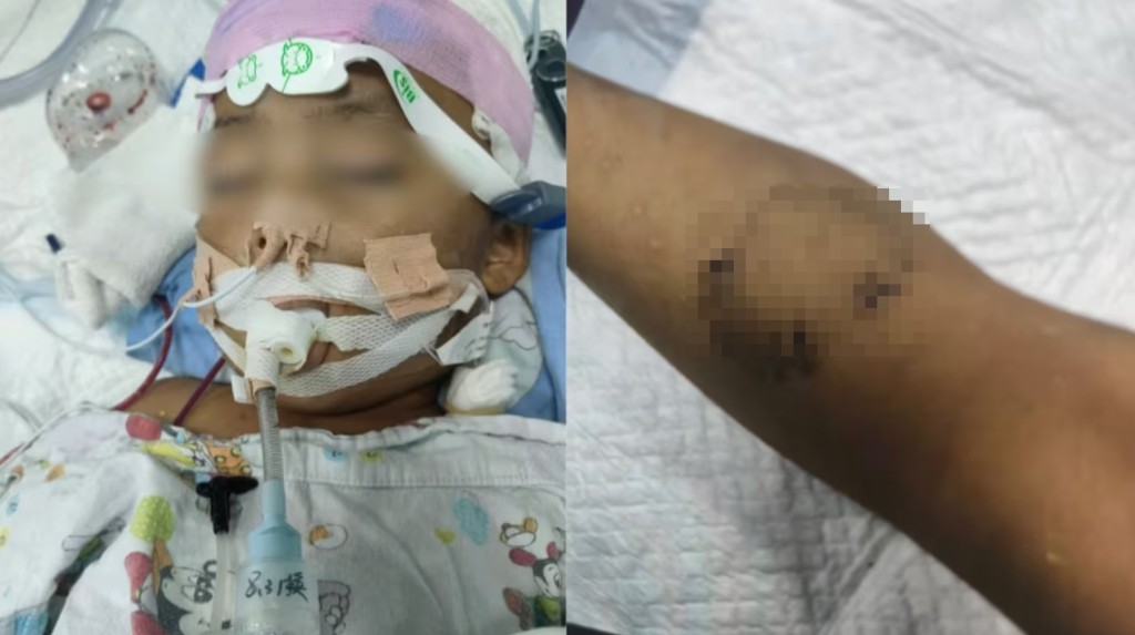 3岁童生父女友频繁对其施以虐待，包括殴打其背部、臀部、腿部，以及用牙齿啃咬其腿部。