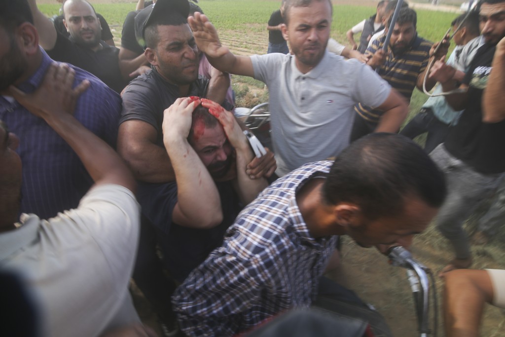 一名受伤的以色人质被带到加沙地带。美联社