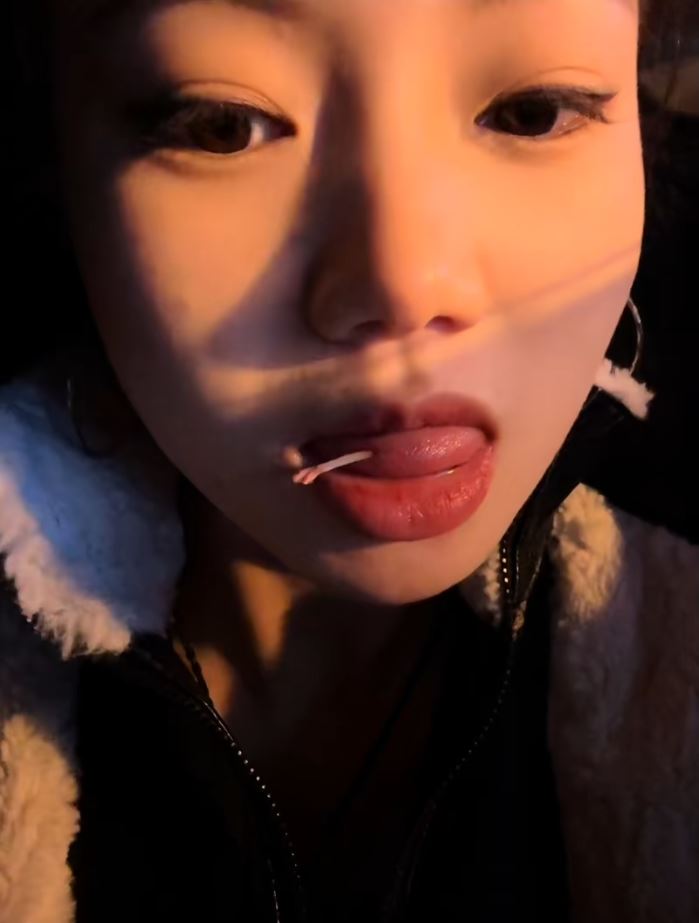 羅小姐吃黃辣丁魚時被其背鯺硬刺插入舌頭，連跑3間醫院才成功「拔骨」。抖音＠獨美