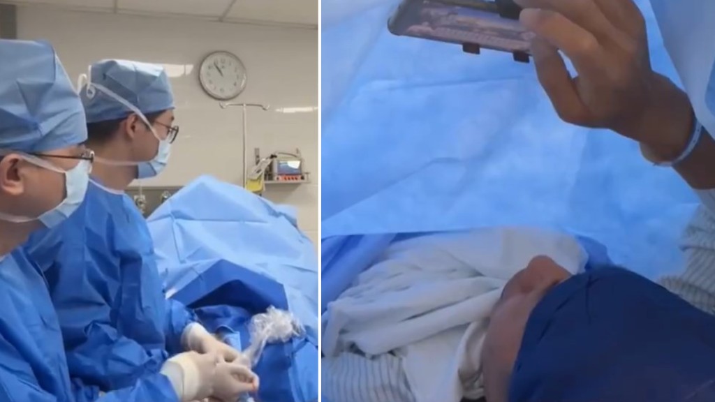 王叔獲醫生允許一邊做手術一邊打機。廣東電視台