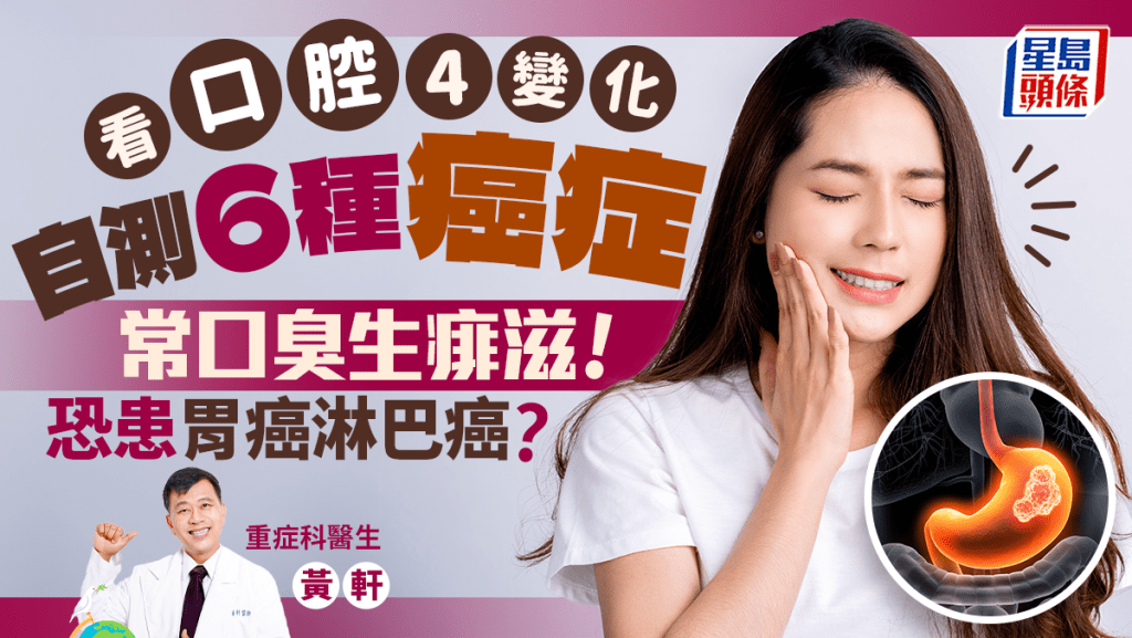 看口腔4變化自測6種癌症！經常口臭生痱滋 恐是胃癌淋巴癌先兆？