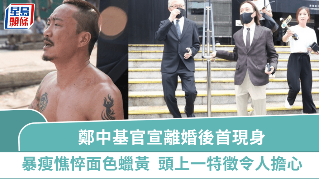 鄭中基官宣離婚神隱2月終現身 暴瘦憔悴面色蠟黃「冇眼睇」 頭上一特徵令人擔心