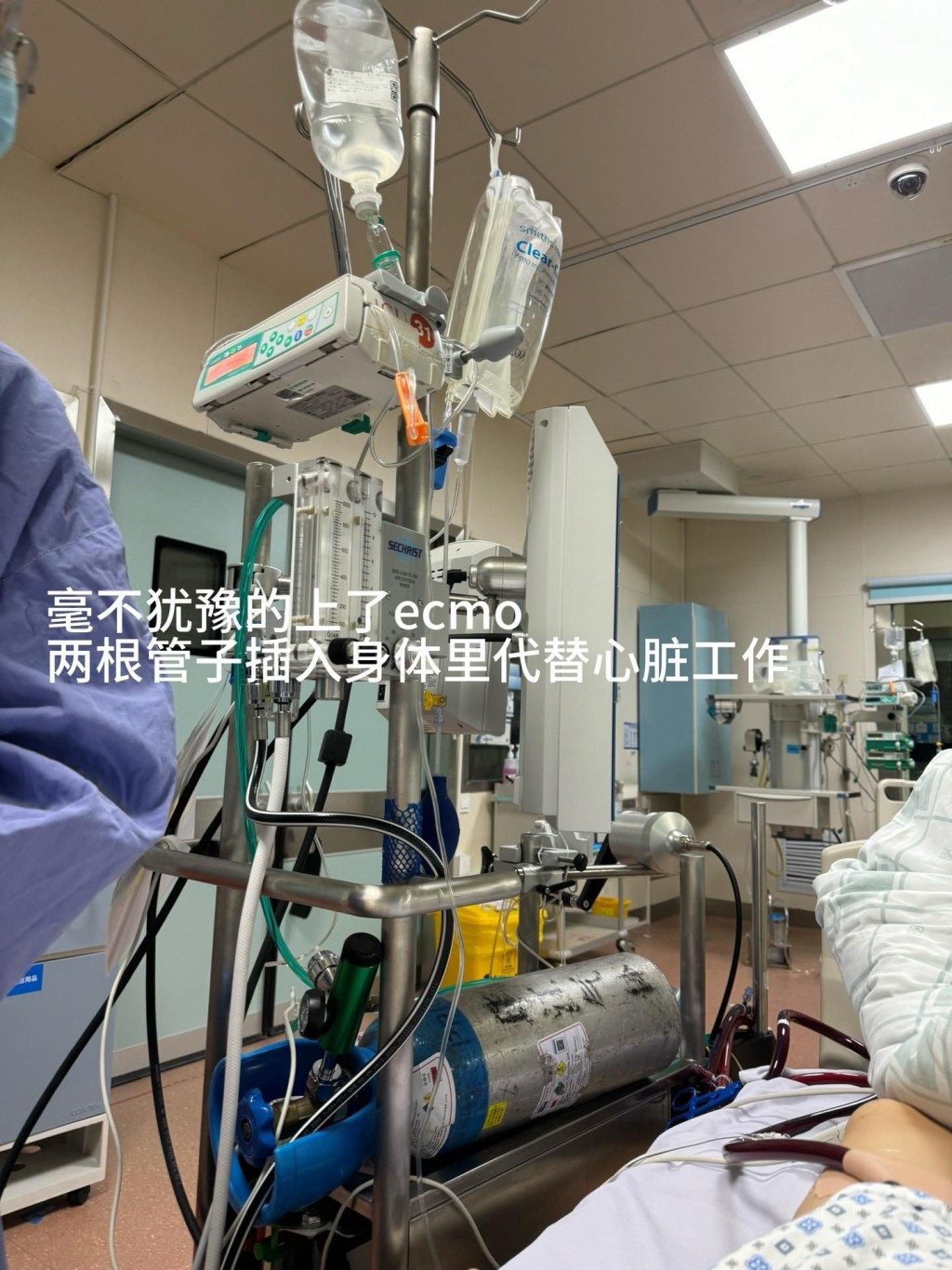 医生进一步为她安装人工心肺（ECMO）。（图片来源：抖音「姐姐跑不了」）