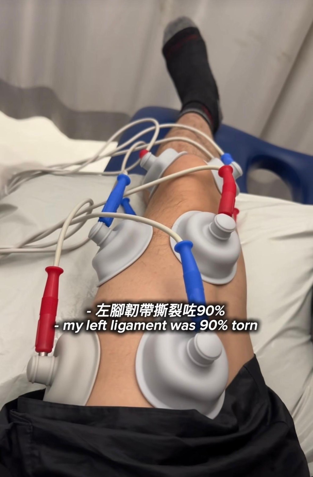 ANSONBEAN拍剧集《存酒人》致左脚韧带90％撕裂，对未来茫然。