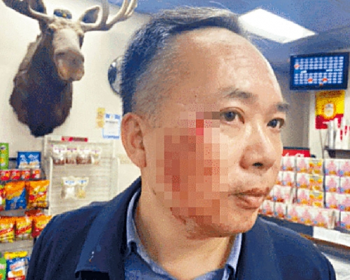 湖南教授周批改在美遇劫受傷。