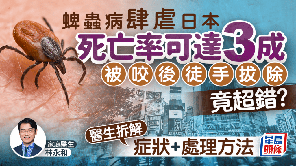 遊日注意｜蜱蟲病肆虐日本可致死 被咬後徒手拔除竟超錯？醫生拆解症狀+處理方法