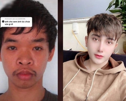 越南男子杜文奎整容前被嘲樣貌醜找不到工作(左)，結果他整容九次變成另一個樣子(右)。網圖
