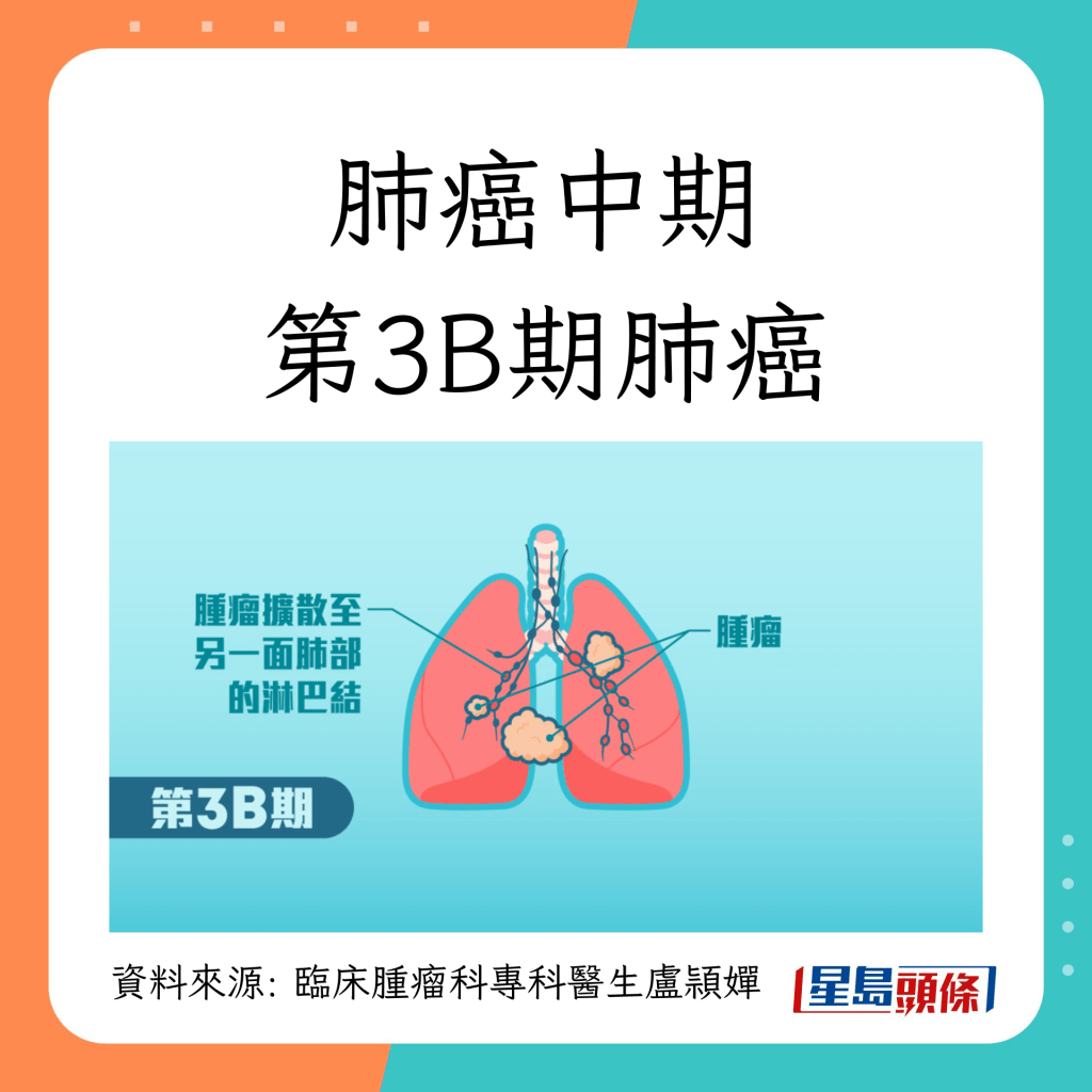 肺癌第1至4期治疗方法