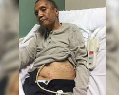 马拉博身上满是被蚂蚁咬过的红斑痕迹。网图