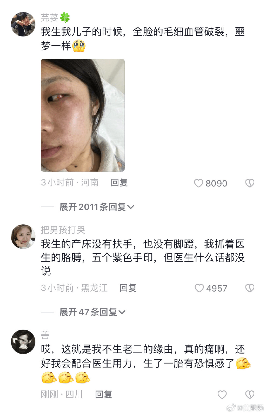 有妈妈引起共鸣，发布脸部生完仔后微丝血管爆裂的照片。