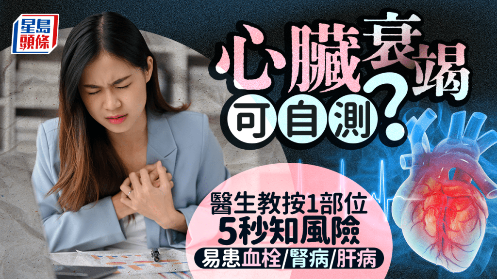 心臟衰竭可自測?醫生教按1部位5秒知風險 易患血栓/腎病/肝病