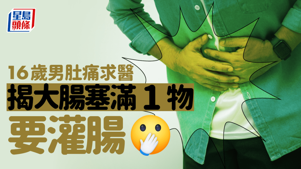 一名16歲少年因肚劇痛求醫,檢查後發現腸道內塞滿1物要灌腸。