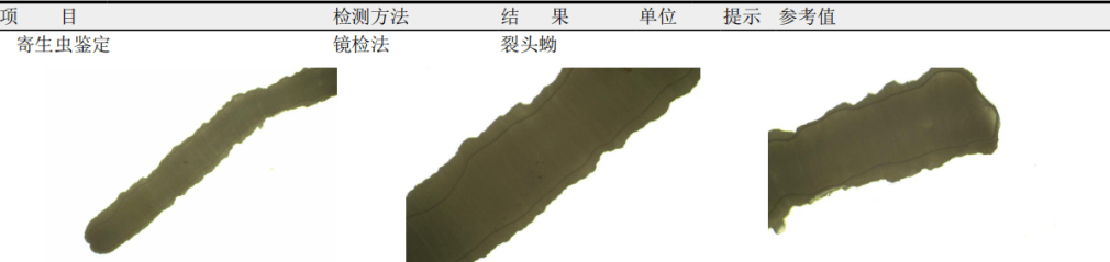 醫院寄生蟲鑒定。 醫院寄生蟲鑒定。