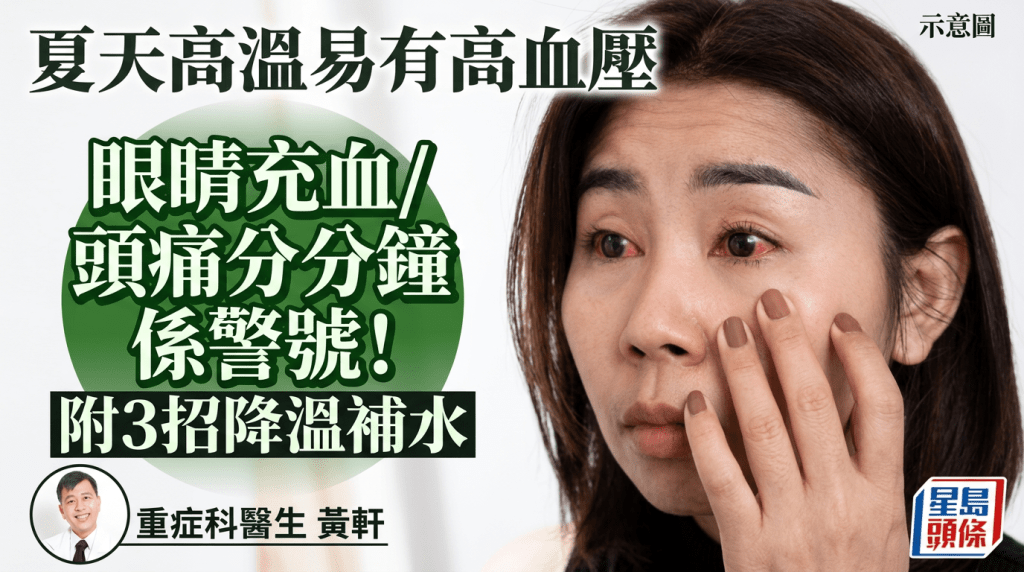 夏天高温易有高血压 眼睛充血/头痛恐是警号 附3招降温补水