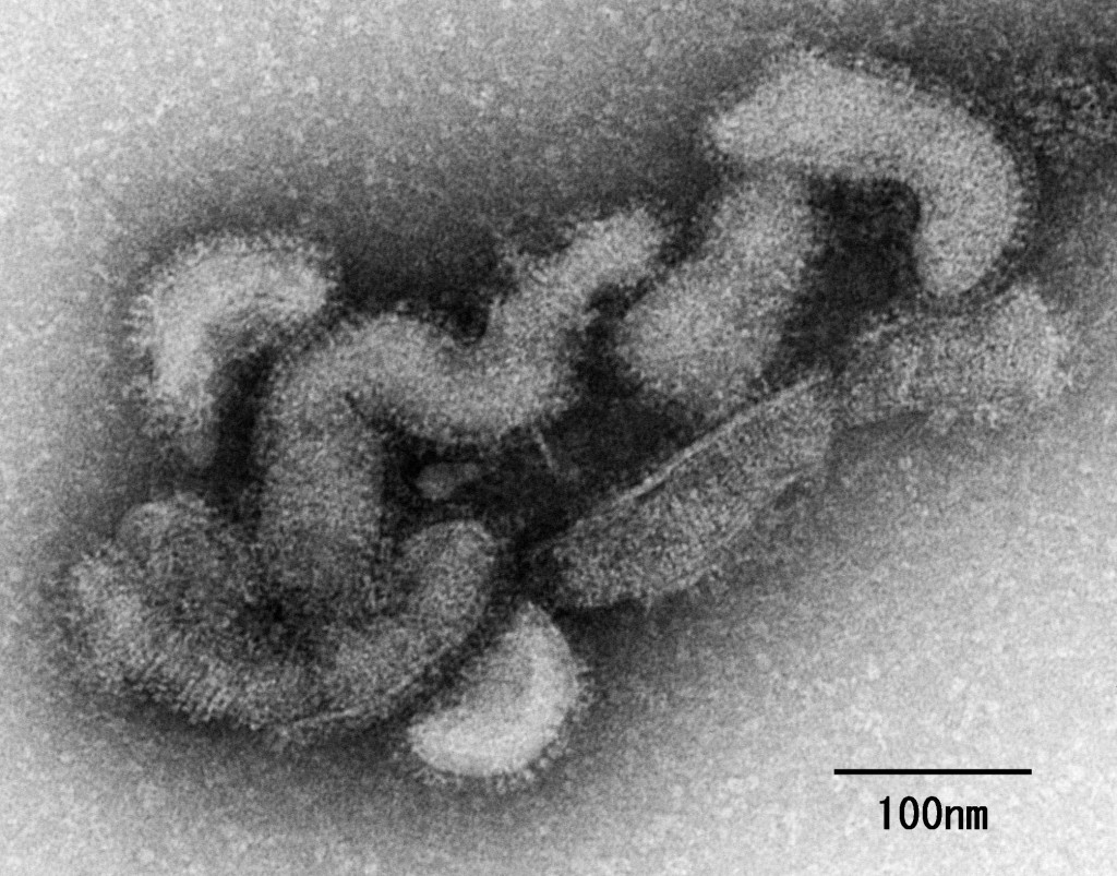 电子顕微镜下的奥兹病毒柆子。 日本国立传染病研究所